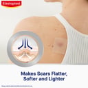 ELASTOPLAST SCAR REDUCER 3.8CM X 6.8CM 21 PATCHES thumbnail 3