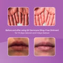 EGO QV DERMCARE STING FREE OINTMENT 200G thumbnail 5