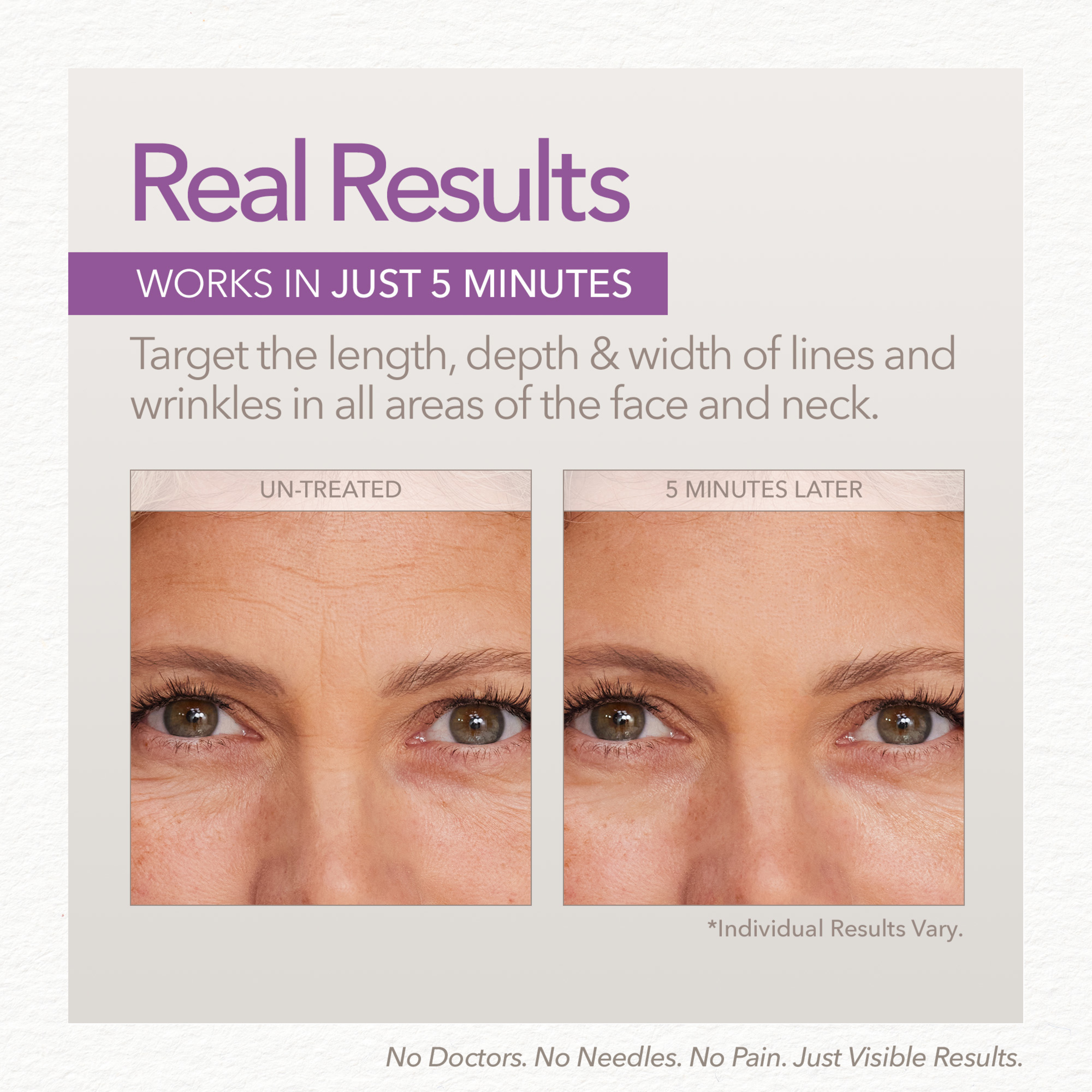 SKIN DOCTORS INSTANT WRINKLE FILLER 10ML - Image 3